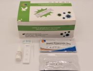 Coronavirus, nelle Marche arriva il test per diagnosi in pochi minuti