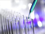 Regione Marche aderisce a sperimentazione su protocollo per uso del plasma a scopo terapeutico