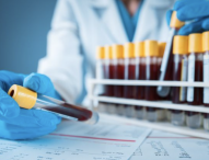 Al via i test sierologici sulla popolazione: in anche anche la Cri Marche