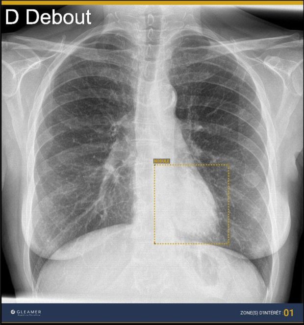 Intelligenza Artificiale a supporto del reparto di Diagnostica degli ospedali di Pesaro e Fano