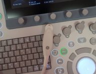 Nuova sonda ecografica all’ospedale San Salvatore di Pesaro